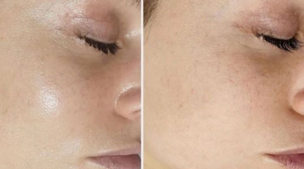 Kosmetologi- og hudpleiesertifikat (Nataliia 10)