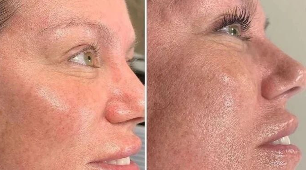 Kosmetologi- og hudpleiesertifikat (Nataliia 11)