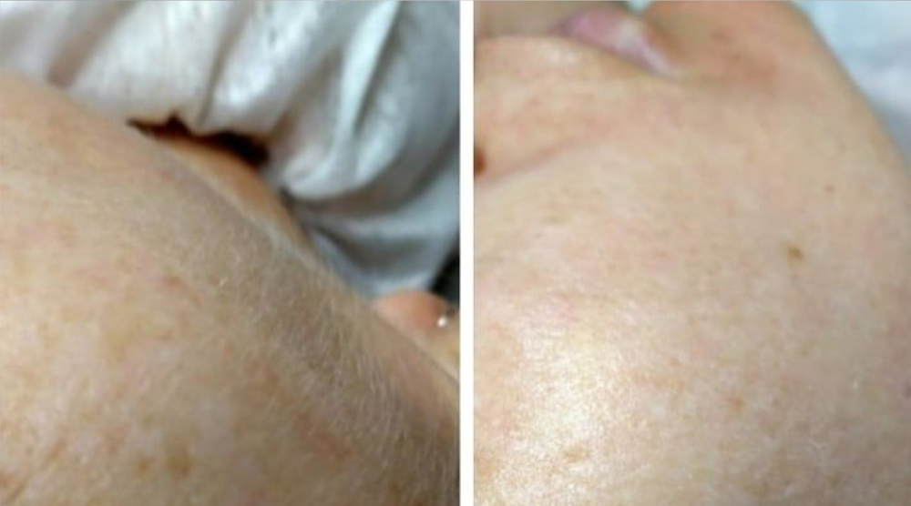 Kosmetologi- og hudpleiesertifikat (Nataliia 6)