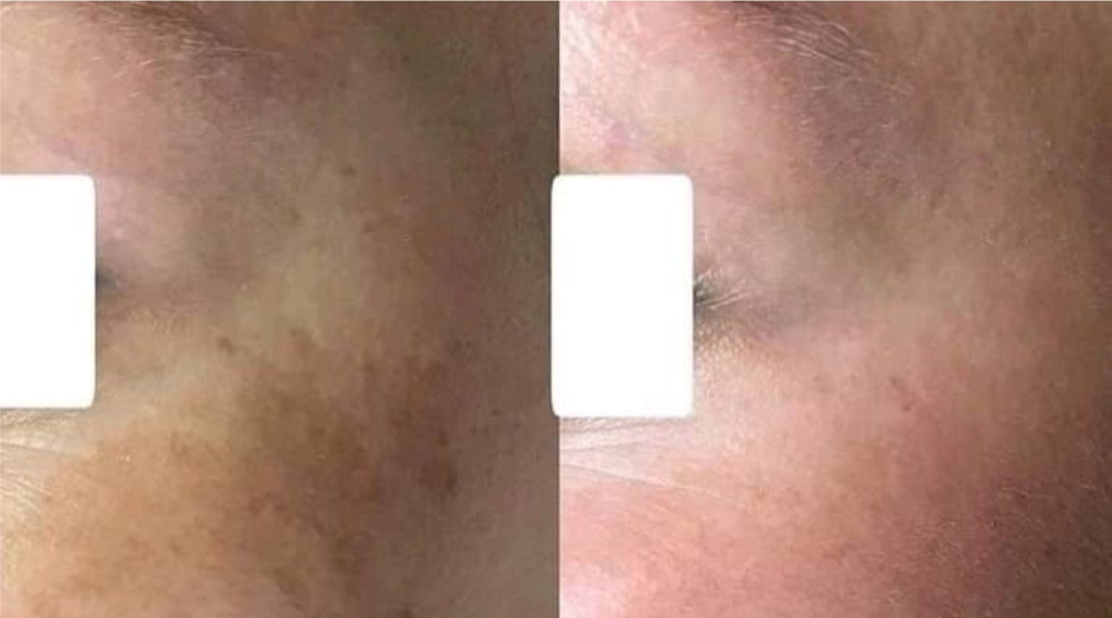 Kosmetologi- og hudpleiesertifikat (Nataliia 7)