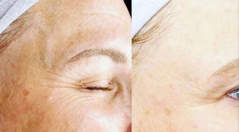 Kosmetologi- og hudpleiesertifikat (Nataliia 8)