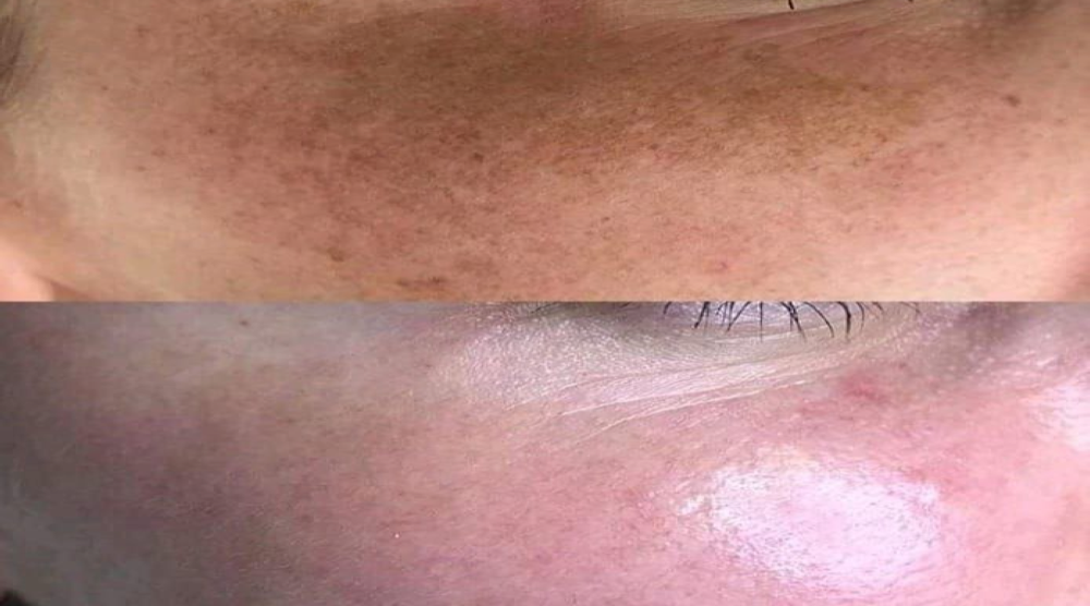 Kosmetologi- og hudpleiesertifikat (Nataliia 9)